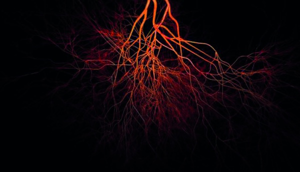 ELEKTRONİK KAN DAMARI