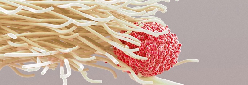 MS gibi Otoimmün Hastalıklar Antijen Spesifik İmmünoterapi Sayesinde Tedavi Edilebilir