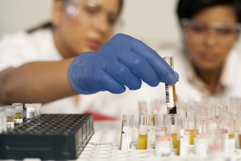 Hastalık Biliminde Teknikerlerin Tanı Koyma Süreci Önem Kazanıyor