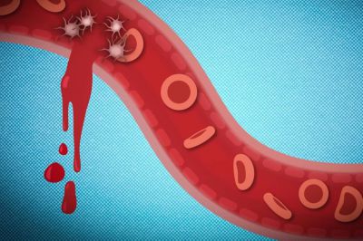 İç Kanamayı Durdurmak İçin Nano Seviyede Tedavilerde Boyut Önemli