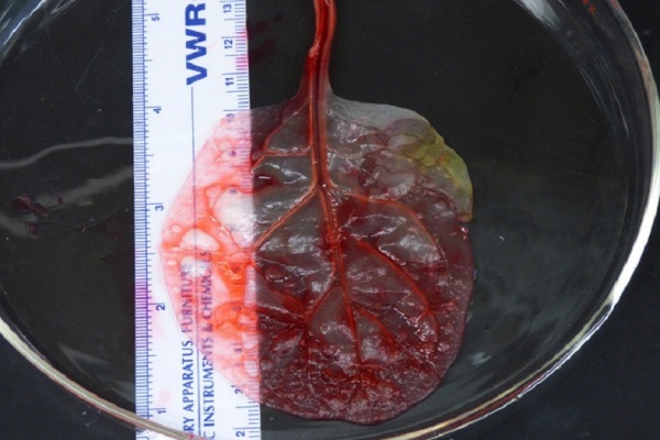 Ispanak Yakın Gelecekte Kalp Naklinde Kullanılabilir!