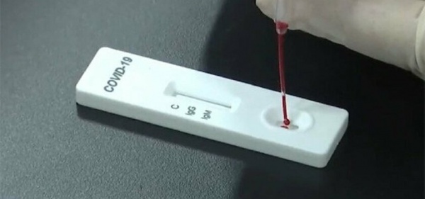 COVID-19 PANDEMİSİ VE UNIBIOSCIENCE TANI KİTLERİ