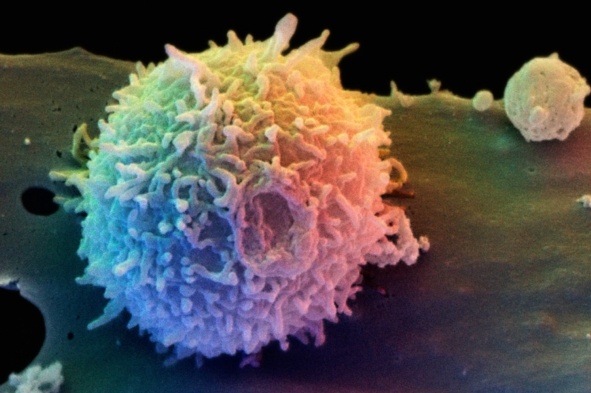 Çin'li Araştırmacılar ilk insan CRISPR denemesinde öncü