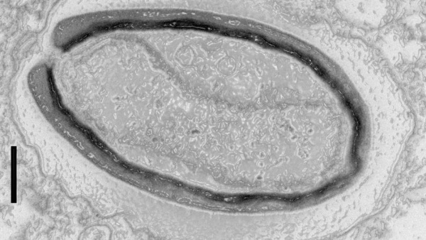 Dev virüsler kendi özgün genlerini üretebiliyorlar