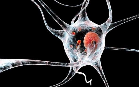 PARKİNSON HASTALIĞININDA “GEN SUSTURMA” YÖNTEMİ