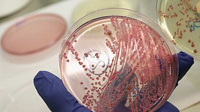 BİLİM İNSANLARI “SUPERBUG” E. COLİ KLONLARININ İNSAN BAĞIRSAĞINI NASIL ELE GEÇİRDİĞİNİ KEŞFETTİ
