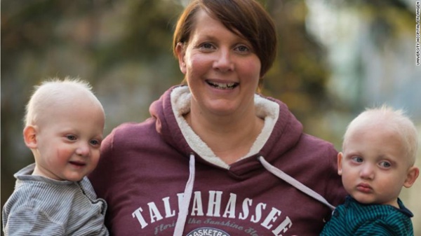 Anne karnında ikiz bebeklere genetik tedavi yapıldı.