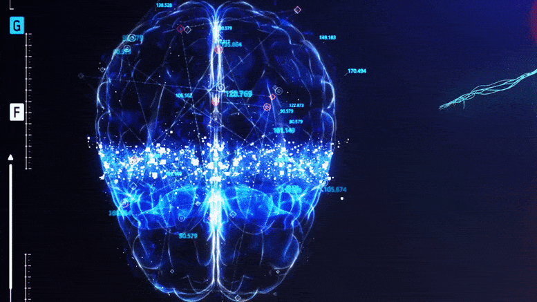 Bir beyin taramasıyla Alzheimer hastalığı hızlı ve doğru bir şekilde teşhis ediliyor